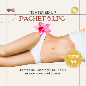 TIGHTENED UP: PACHET 6 LPG 60min